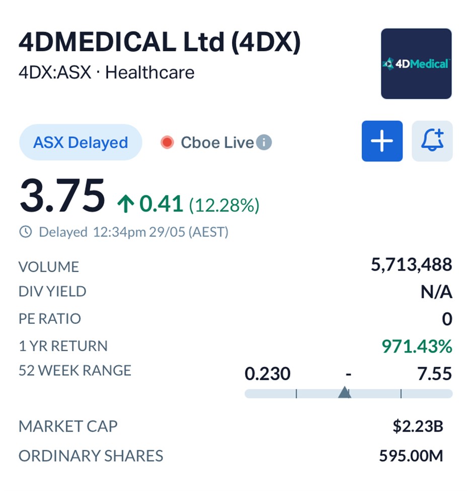 4DMedical (ASX: 4DX) Lands 170-Site US Rollout as SimonMed Opens Door to America’s Outpatient Imaging Market